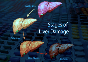 MCTs Disrupt Liver Detox